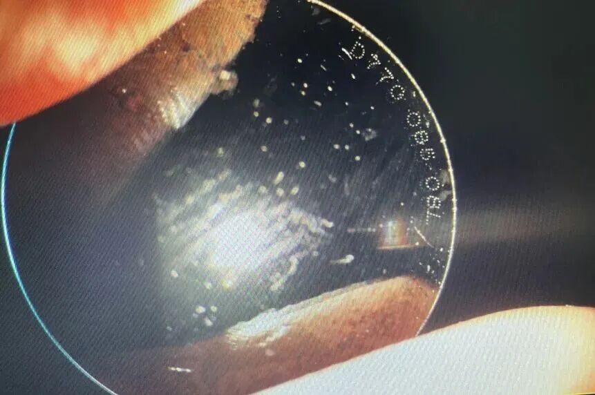 了解ICL晶体植入术以及ICL V5与V4c的区别